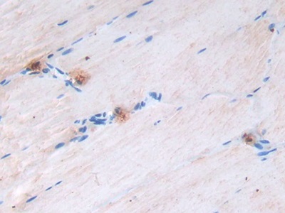 Epidermal Growth Factor (EGF) Rat Monoclonal Antibody