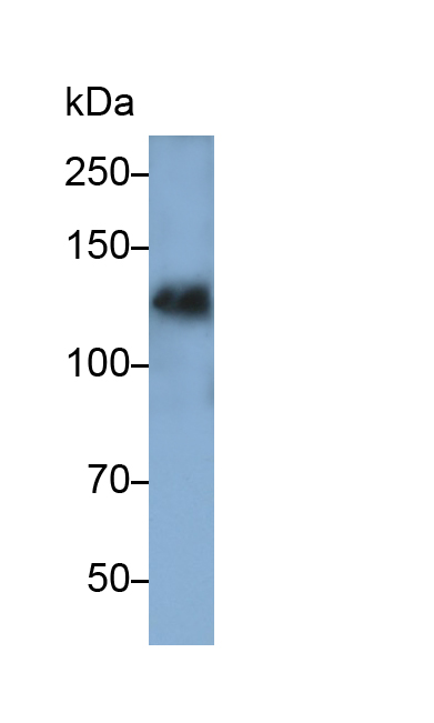 Epidermal Growth Factor (EGF) Rat Monoclonal Antibody