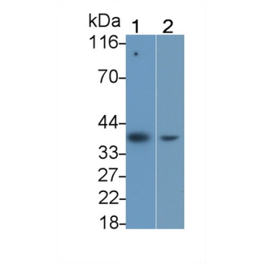Interleukin 1 Beta (IL1b) Human Monoclonal Antibody