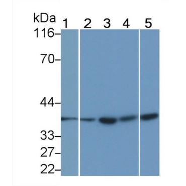 Interleukin 1 Beta (IL1b) Human Monoclonal Antibody