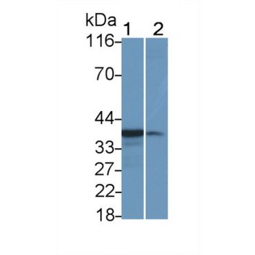 Interleukin 1 Beta (IL1b) Human Monoclonal Antibody
