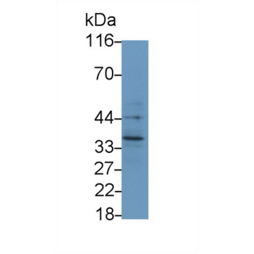 Interleukin 1 Beta (IL1b) Human Monoclonal Antibody