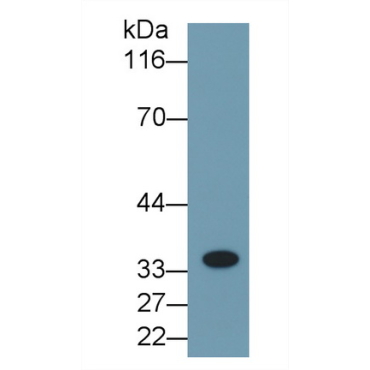 Interleukin 1 Beta (IL1b) Human Monoclonal Antibody