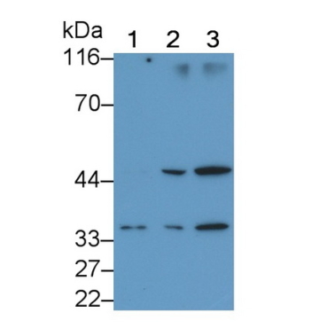 Interleukin 1 Beta (IL1b) Mouse Monoclonal Antibody