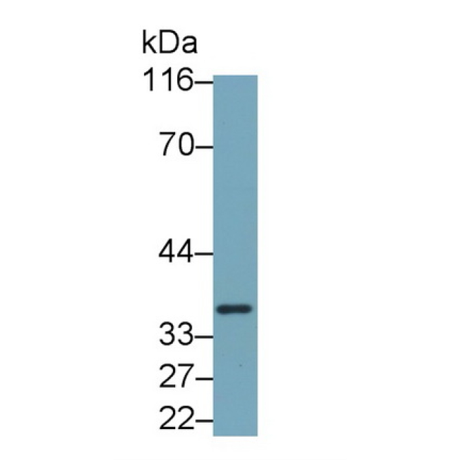 Interleukin 1 Beta (IL1b) Mouse Monoclonal Antibody
