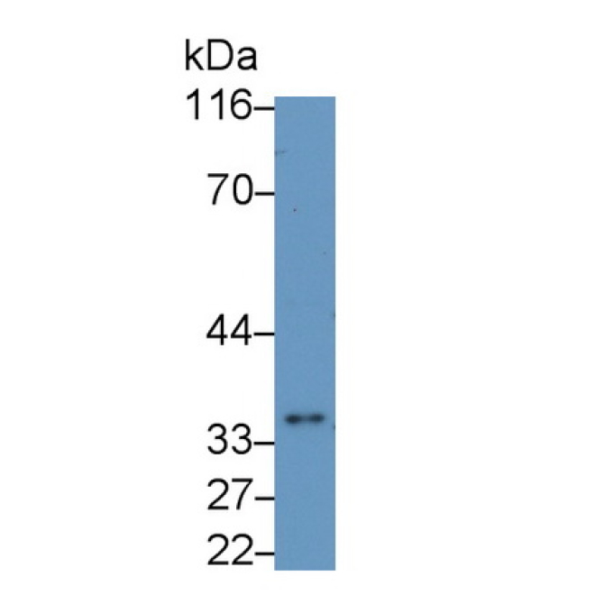 Interleukin 1 Beta (IL1b) Mouse Monoclonal Antibody
