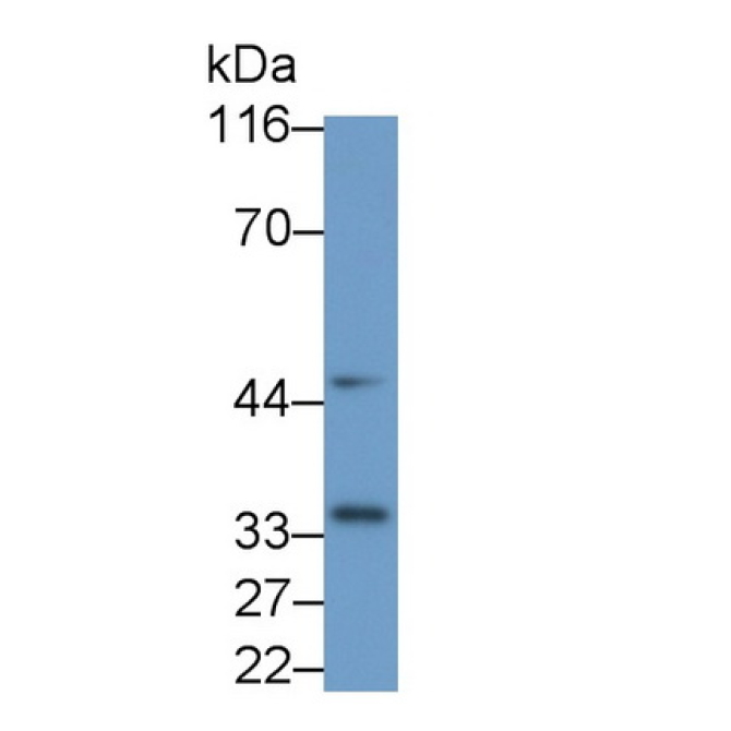 Interleukin 1 Beta (IL1b) Mouse Monoclonal Antibody