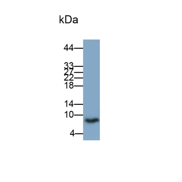 S100 Calcium Binding Protein B (S100B) Human Monoclonal Antibody