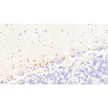 S100 Calcium Binding Protein B (S100B) Human Monoclonal Antibody