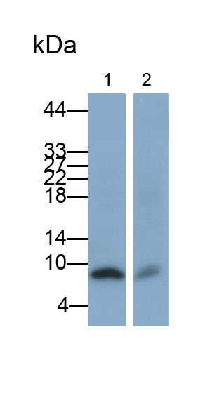 S100 Calcium Binding Protein B (S100B) Rat Monoclonal Antibody