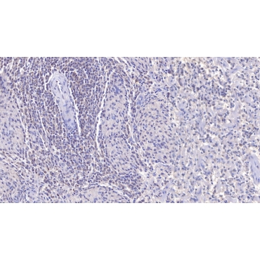 P-Selectin (SELP) Human Monoclonal Antibody