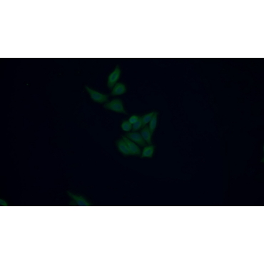 Procollagen III N-Terminal Propeptide (PIIINP) Human, Rat Monoclonal Antibody