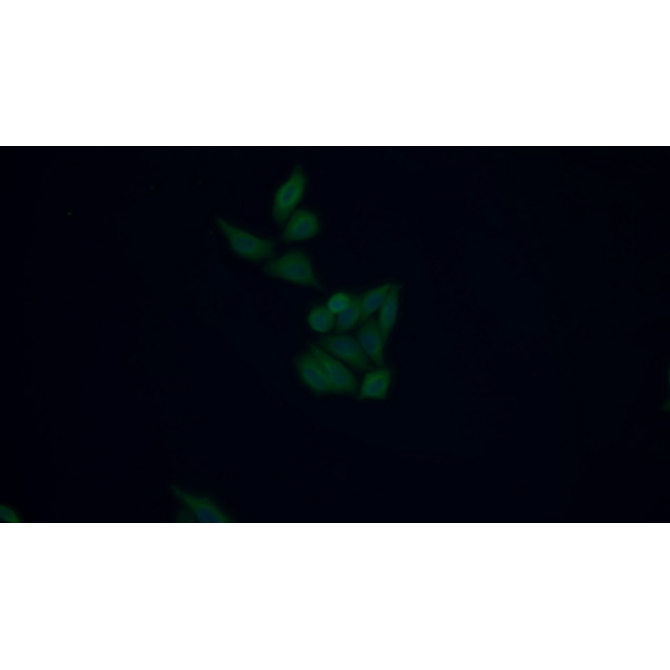 Procollagen III N-Terminal Propeptide (PIIINP) Human, Rat Monoclonal Antibody