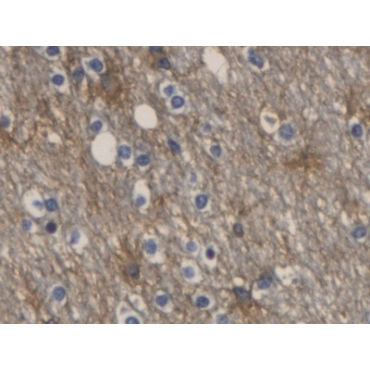 Aquaporin 4 (AQP4) Human Monoclonal Antibody