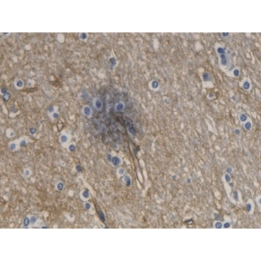 Aquaporin 4 (AQP4) Human Monoclonal Antibody