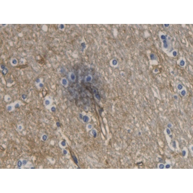 Aquaporin 4 (AQP4) Human Monoclonal Antibody