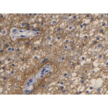 Aquaporin 4 (AQP4) Human Monoclonal Antibody