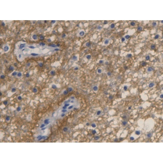 Aquaporin 4 (AQP4) Human Monoclonal Antibody