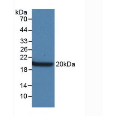 Aquaporin 4 (AQP4) Mouse Monoclonal Antibody