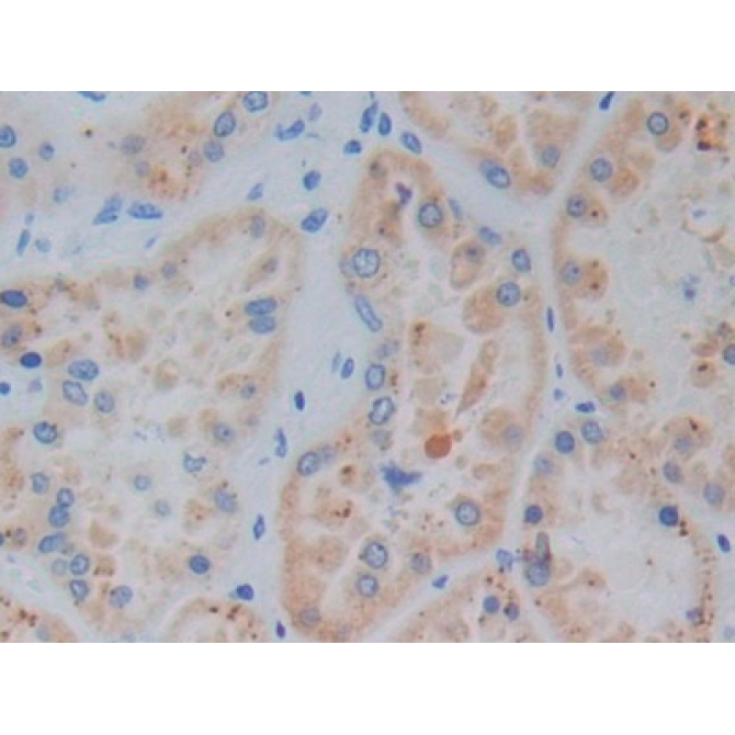 Heme Oxygenase 1 (HO1) Human Monoclonal Antibody