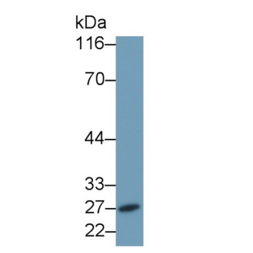 Granzyme B (GZMB) Human Monoclonal Antibody