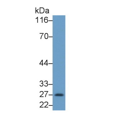 Granzyme B (GZMB) Human Monoclonal Antibody
