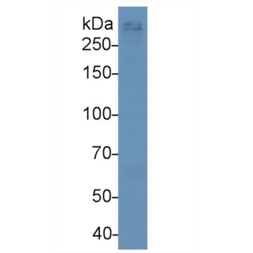 Apolipoprotein B100 (APOB100) Human Monoclonal Antibody