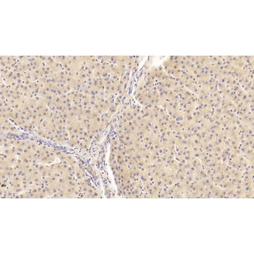 Apolipoprotein B100 (APOB100) Human Monoclonal Antibody