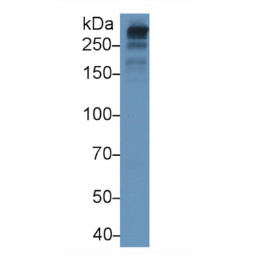 Apolipoprotein B100 (APOB100) Human Monoclonal Antibody