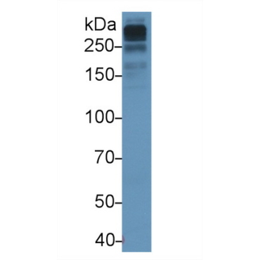 Apolipoprotein B100 (APOB100) Human Monoclonal Antibody