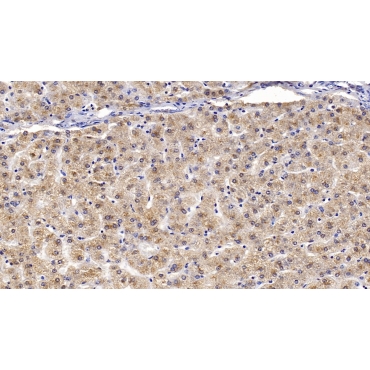 Apolipoprotein B100 (APOB100) Human Monoclonal Antibody