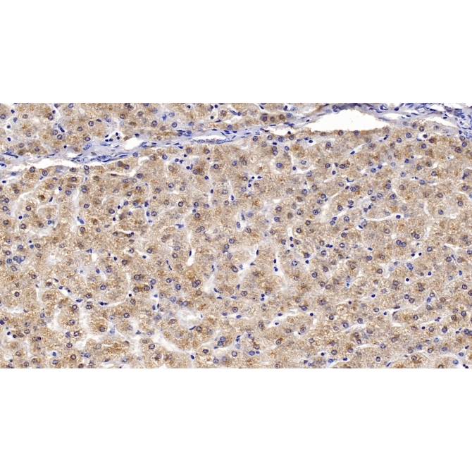 Apolipoprotein B100 (APOB100) Human Monoclonal Antibody
