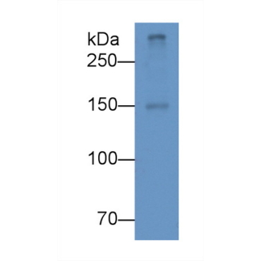 Apolipoprotein B100 (APOB100) Human Monoclonal Antibody