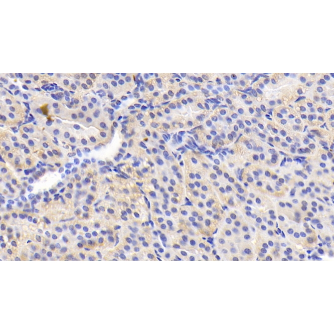 Adiponectin (ADPN) Human Monoclonal Antibody