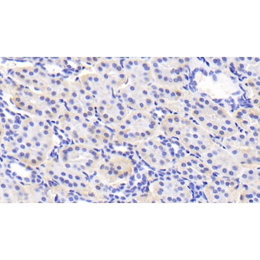 Adiponectin (ADPN) Human Monoclonal Antibody