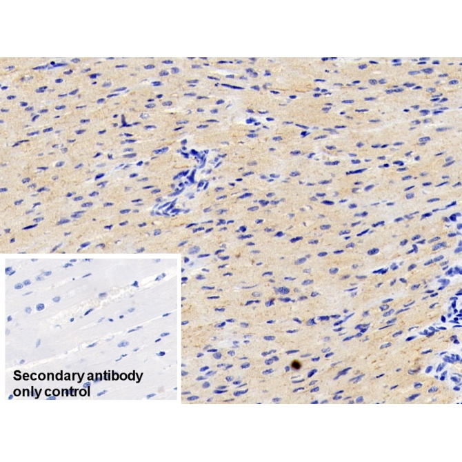 Adiponectin (ADPN) Human Monoclonal Antibody