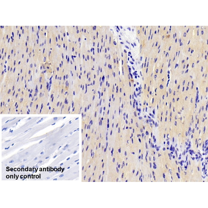 Adiponectin (ADPN) Human Monoclonal Antibody