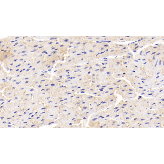 Adiponectin (ADPN) Human Monoclonal Antibody