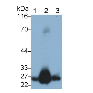 Glutathione S Transferase Alpha 1 (GSTa1) Human Monoclonal Antibody