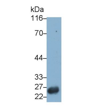 Glutathione S Transferase Alpha 1 (GSTa1) Human Monoclonal Antibody