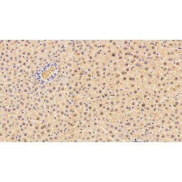 Glutathione S Transferase Alpha 1 (GSTa1) Human Monoclonal Antibody