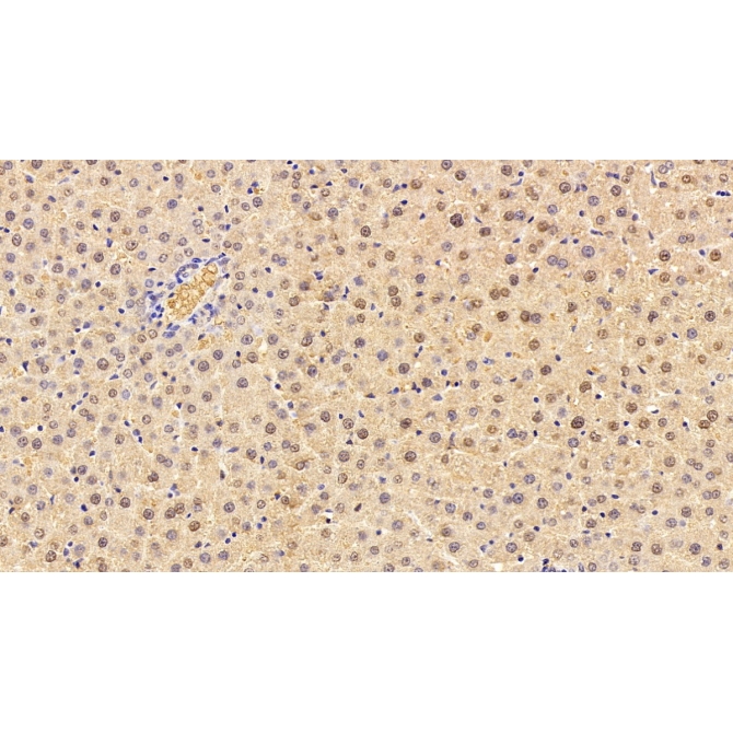 Glutathione S Transferase Alpha 1 (GSTa1) Human Monoclonal Antibody