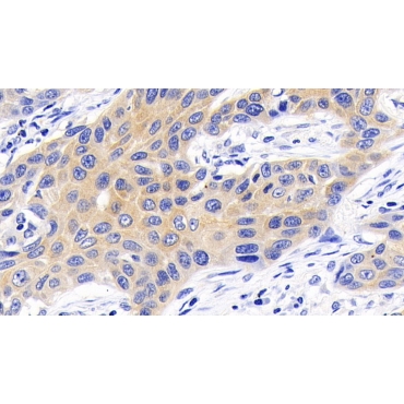 Caspase 9 (CASP9) Human Monoclonal Antibody