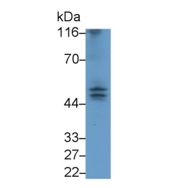 Caspase 9 (CASP9) Human Monoclonal Antibody