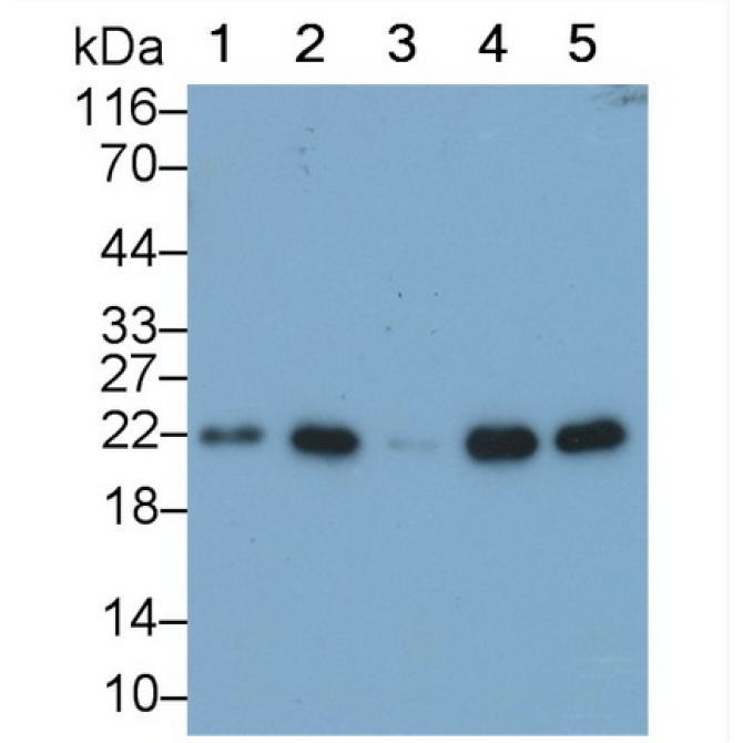 BH3 Interacting Domain Death Agonist (Bid) Human Monoclonal Antibody
