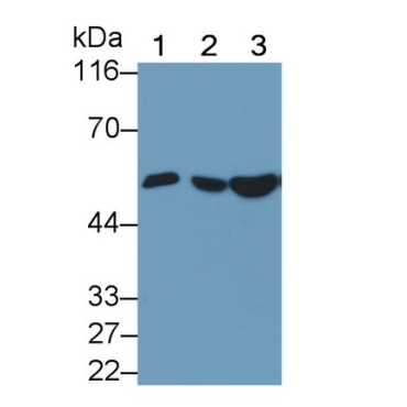 Visfatin (VF) Human Monoclonal Antibody