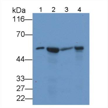 Visfatin (VF) Human Monoclonal Antibody