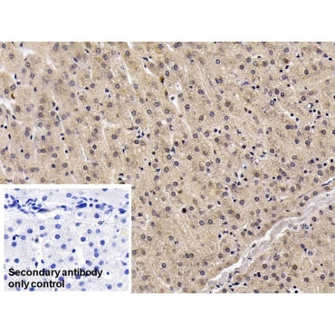 Visfatin (VF) Human Monoclonal Antibody