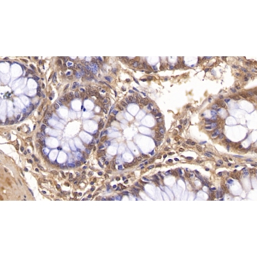 Visfatin (VF) Human Monoclonal Antibody