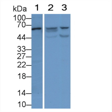 Visfatin (VF) Human Monoclonal Antibody